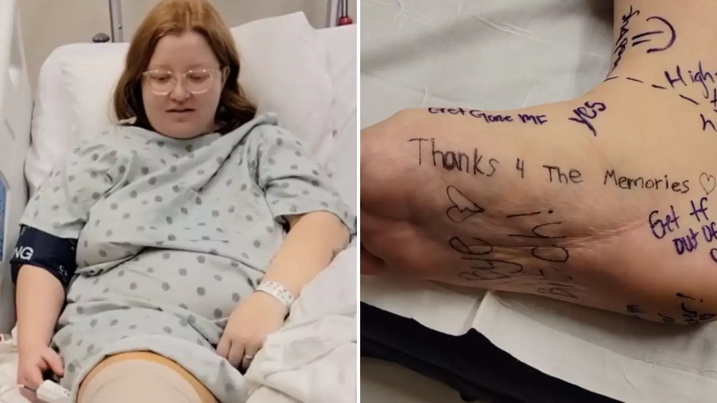 Woman decides to have foot amputated after 15 years of ‘crippling pain’