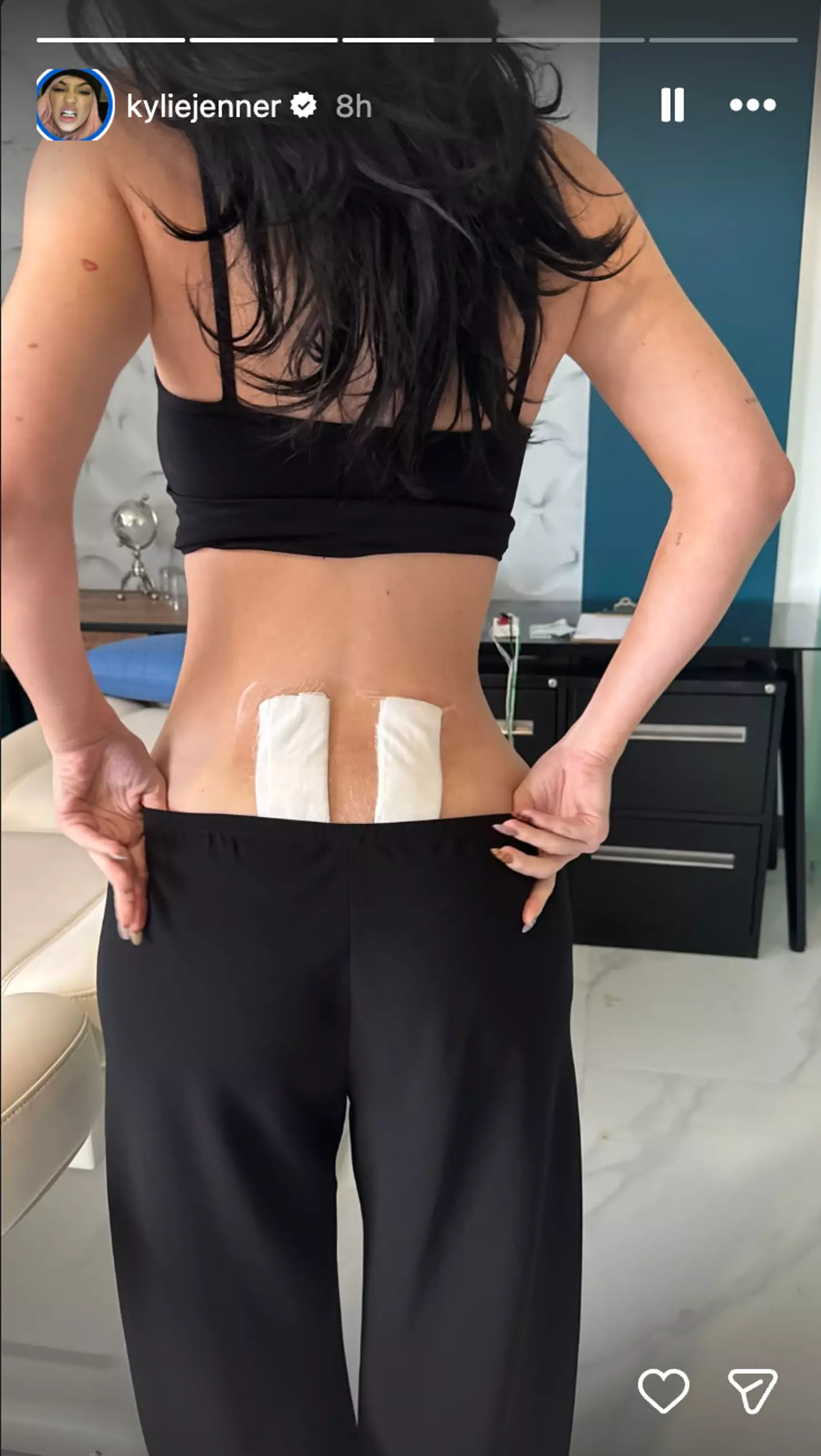 Kylie said it was a 'huge step' in her healing (Instagram/@kyliejenner)