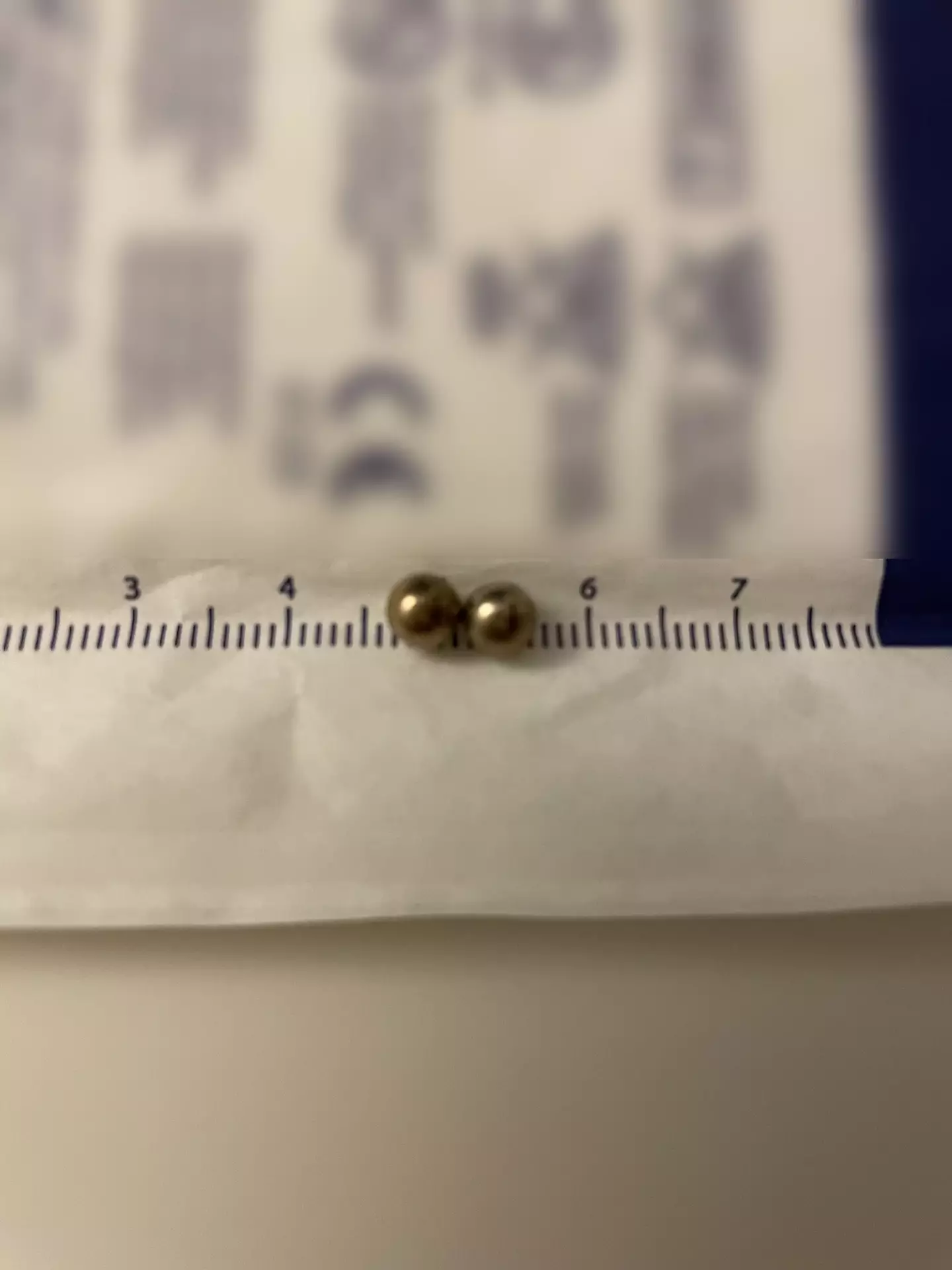 The magnets Falyn swallowed.