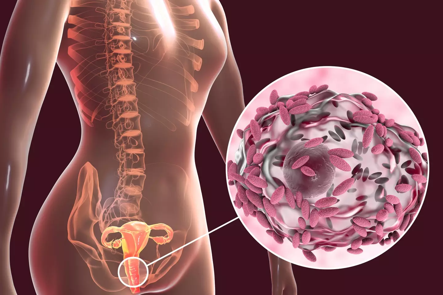 BV is a common cause of 'unusual' vaginal discharge (KATERYNA KON/SCIENCE PHOTO LIBRARY / Getty Images)