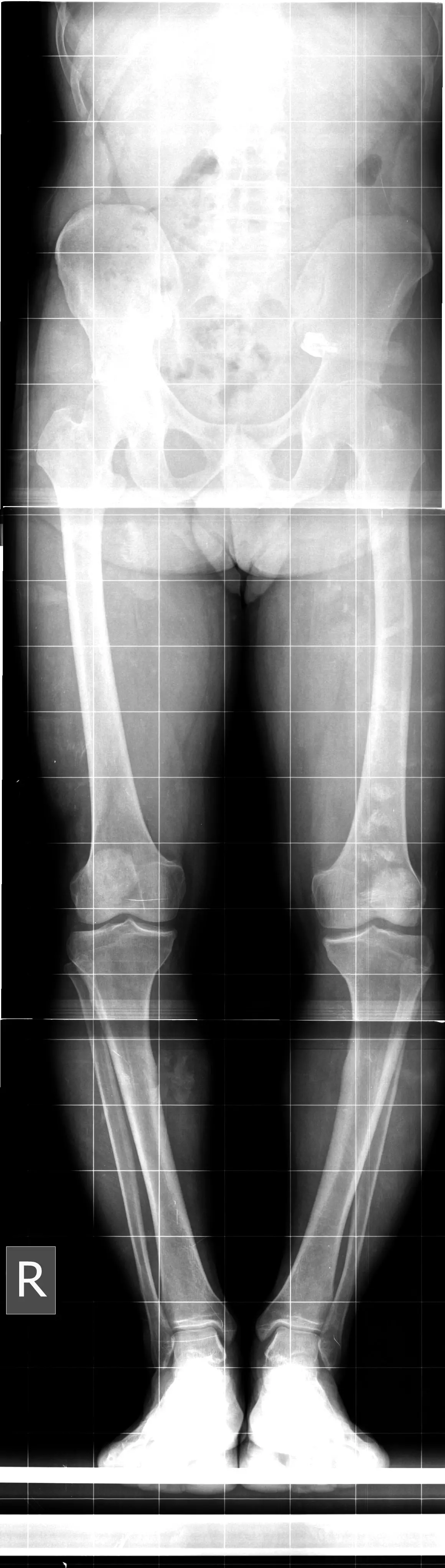 It turns out that men have got some seriously concerning things stuck in their penises (Getty Stock Image)