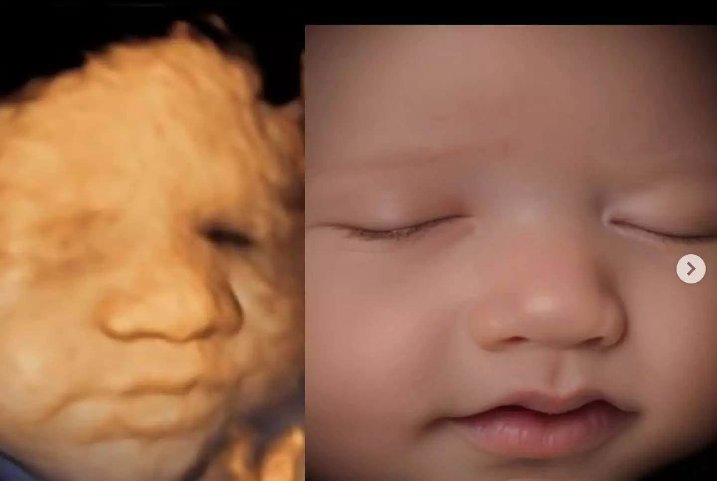 The mum-to-be shared an ultrasound of her unborn daughter (Instagram/@gypsyrose.ig)