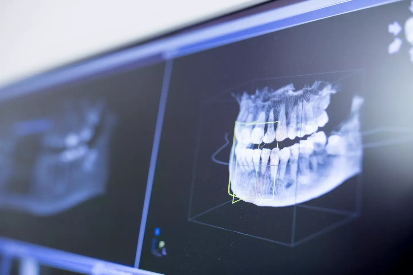 Not all signs of oral cancer are directly in the mouth (Getty Stock Image)