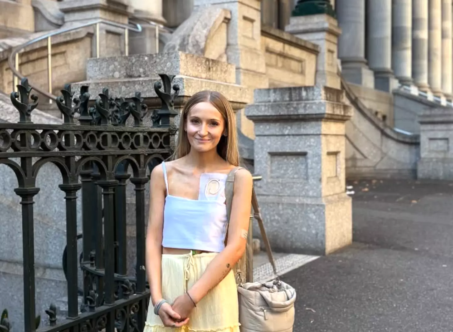 Annaliese Holland has chosen to end her life through assisted dying at the age of 25 (Instagram/@annaliese_holland)