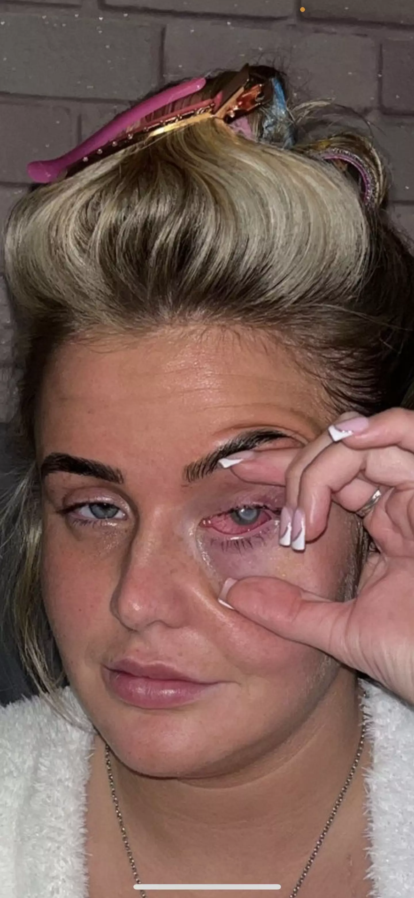 Lillie is now considering surgery. (Kennedy)