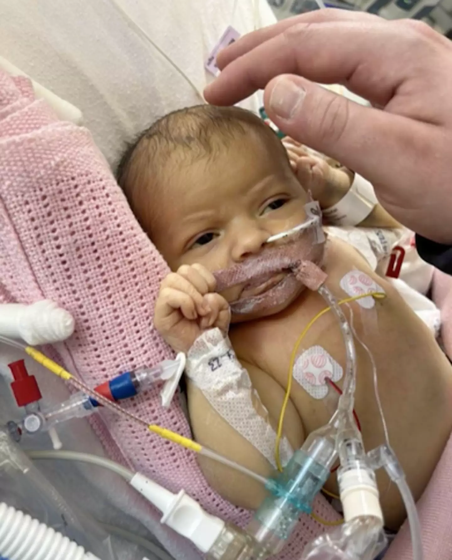 The grieving parents are now looking to raise awareness of the dangers of family and friends touching and kissing babies (SWNS)