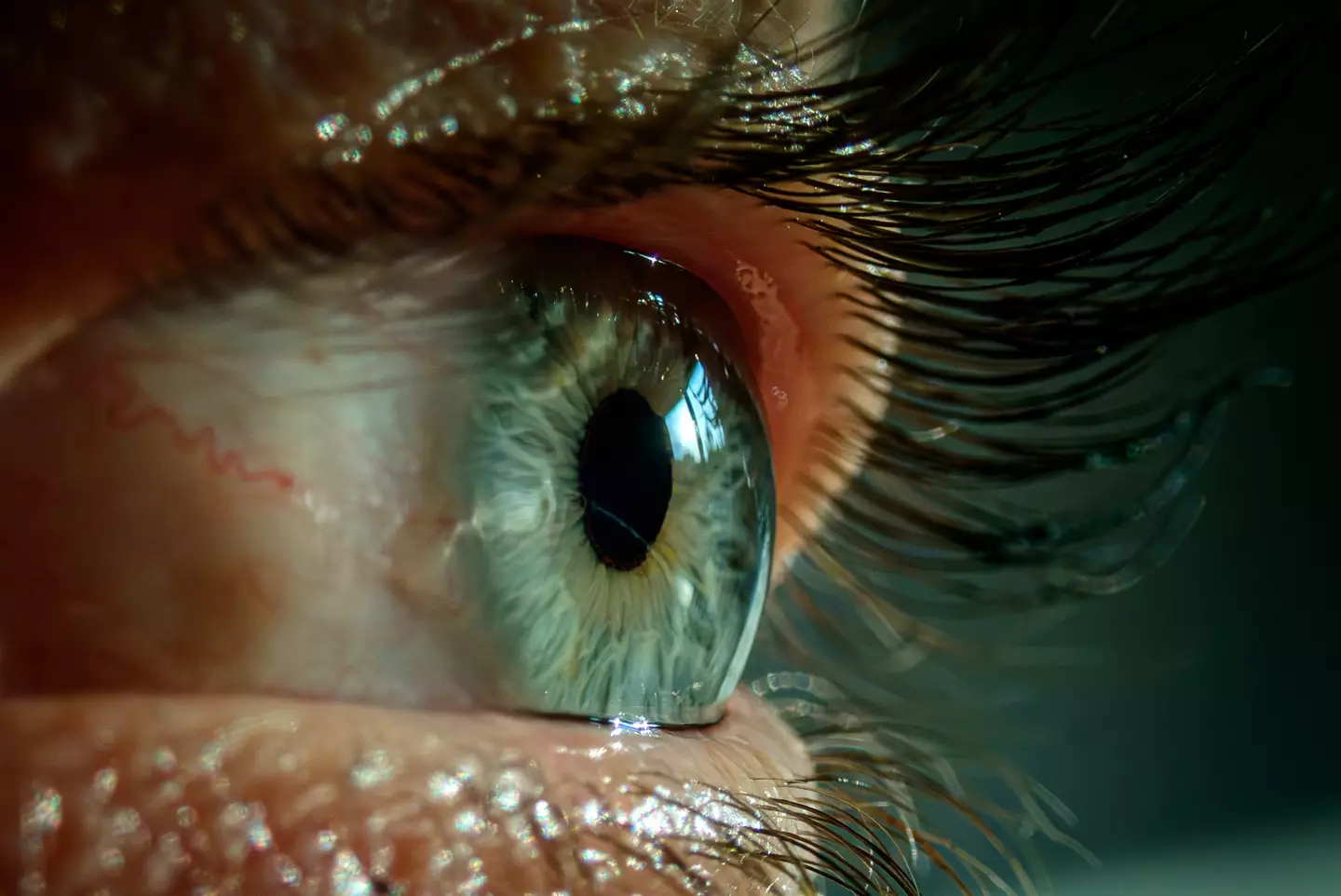 The optic nerve is often the first place where the condition shows it is present. (Getty stock images)