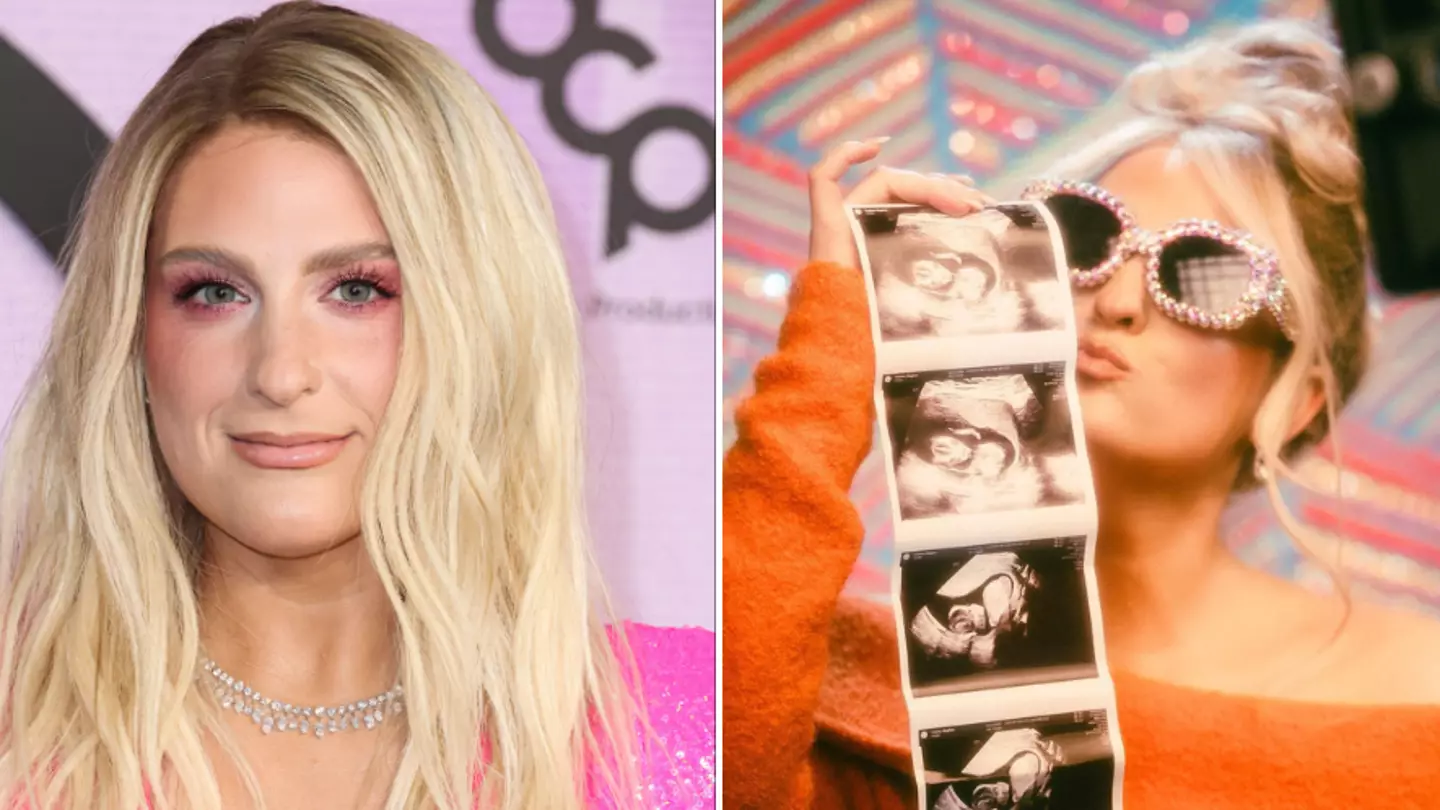 Meghan Trainor announces she’s pregnant with her second child