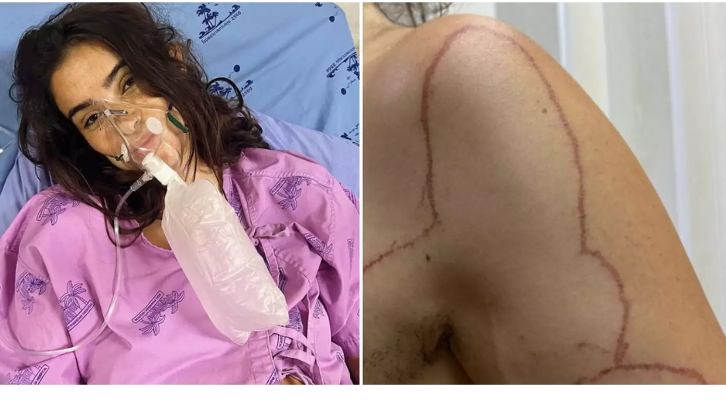 Woman issues urgent warning to ‘stay safe whilst swimming’ after being hospitalised on holiday