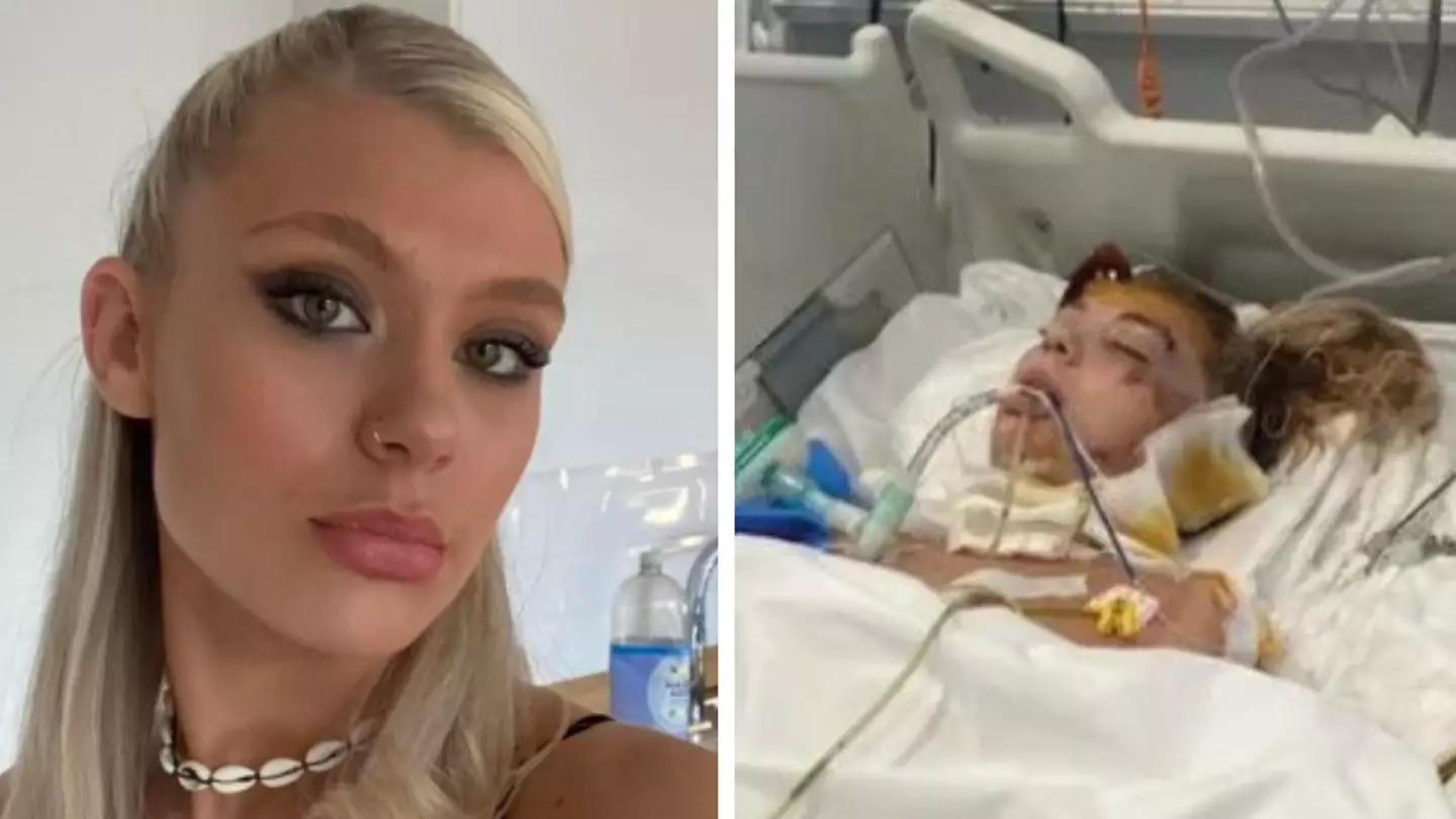 Woman with broken spine wakes up from coma following horrifying Ayia Napa crash