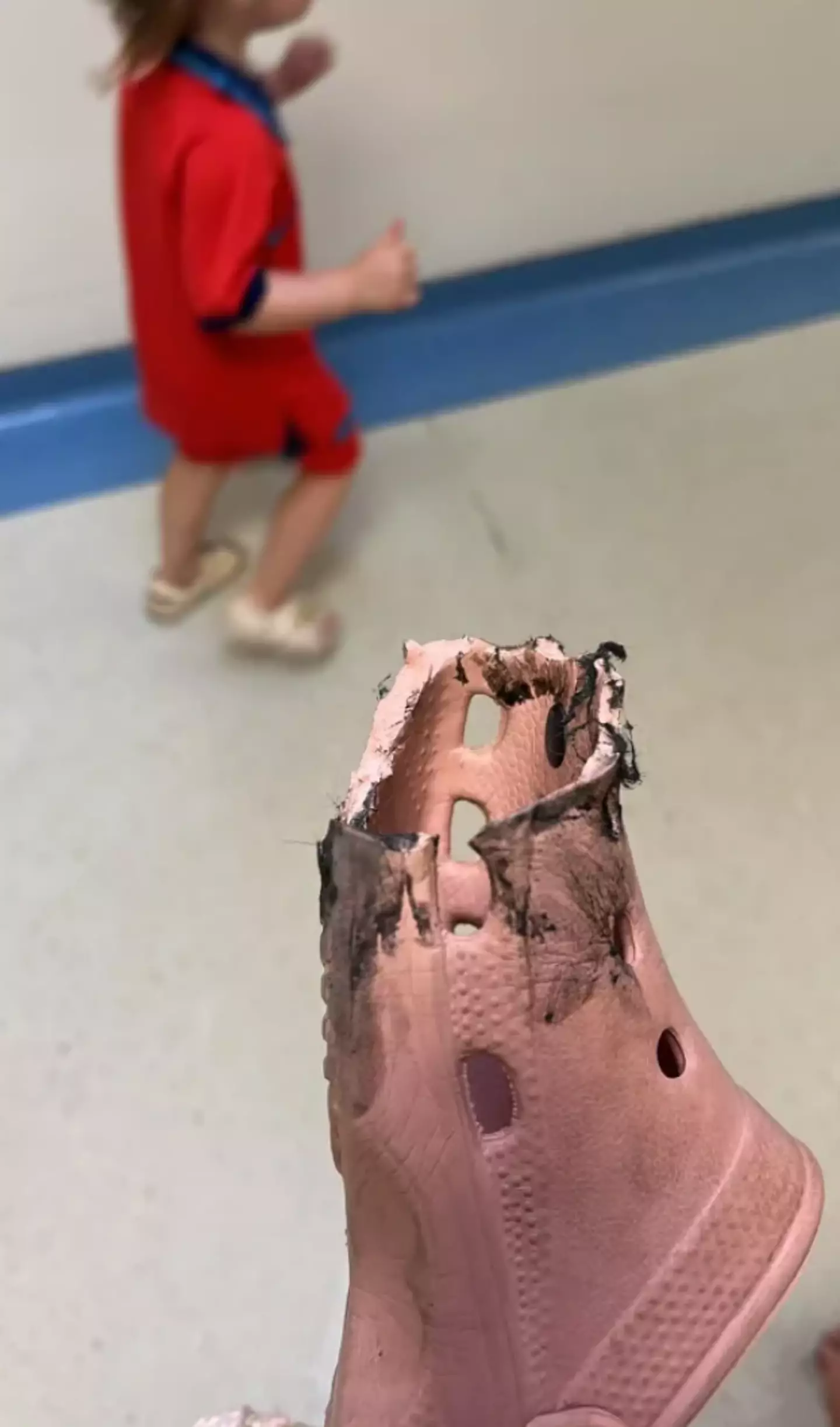 The entire toe was ripped from the rest of the shoe.