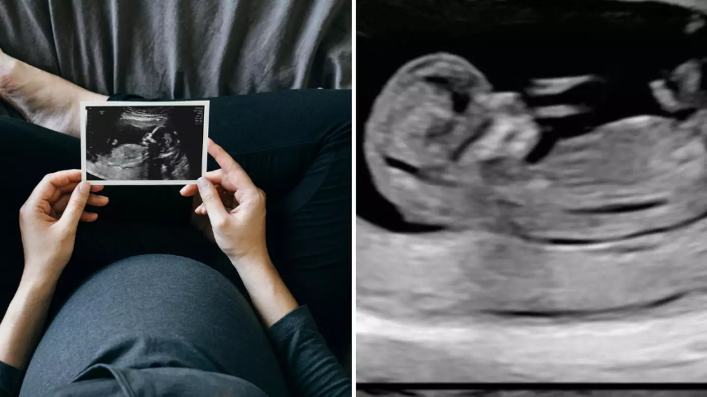 Woman’s pregnancy announcement leaves people furious after friend’s 'bitter' fat shaming reply