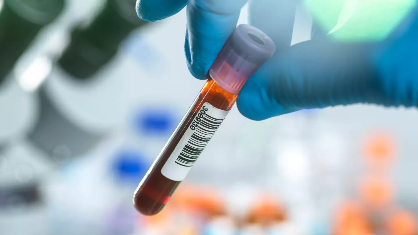 Scientists reveal the one blood type which has the lowest risk of heart disease