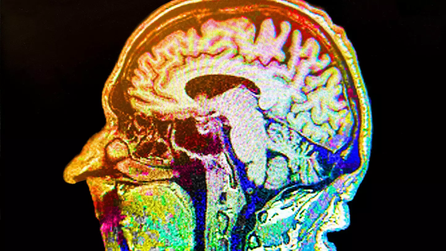 Experts reveal the most overlooked early warning signs of Alzheimer's