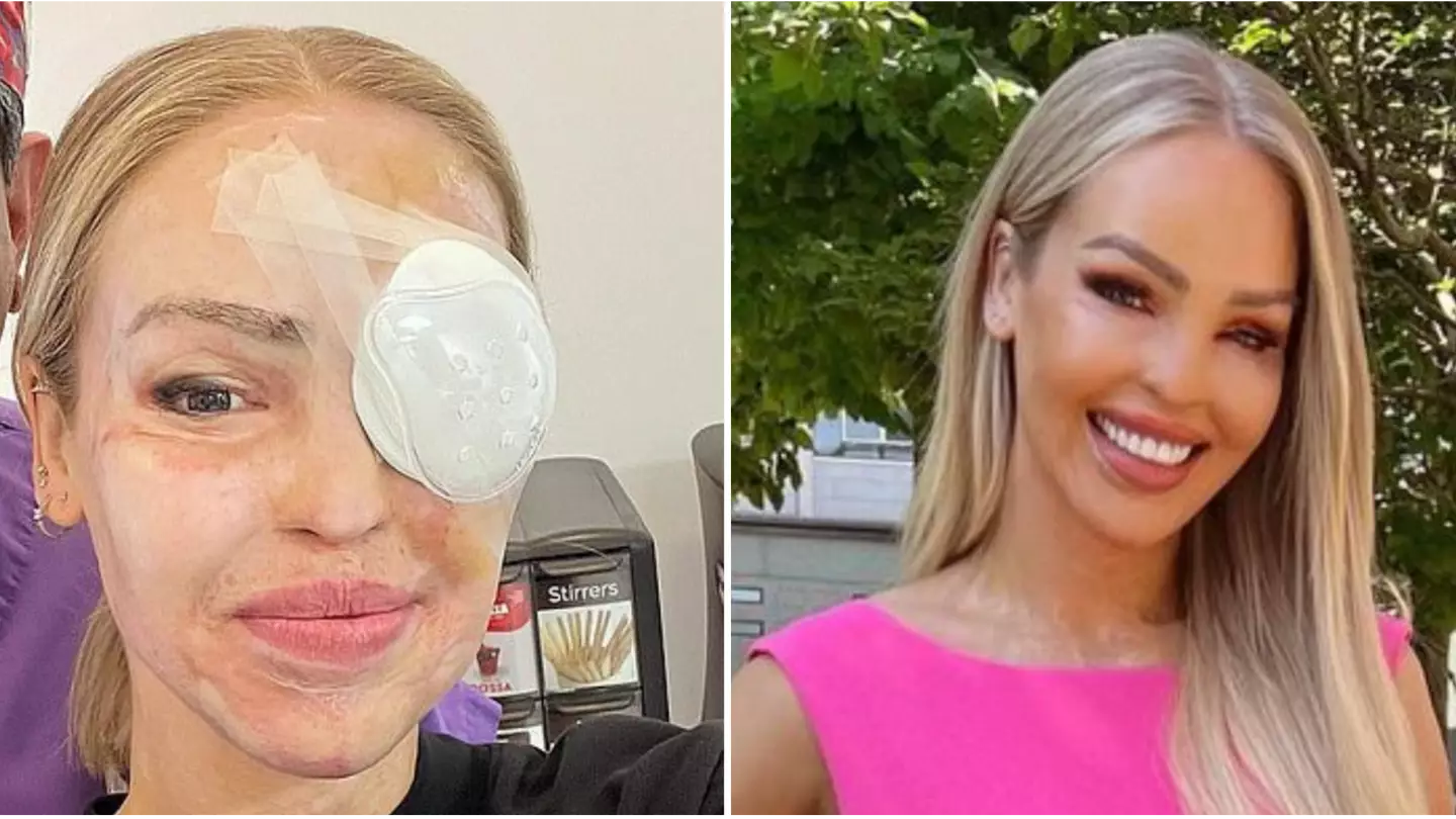 Katie Piper issues health update as she details 'nightmare' eye issues