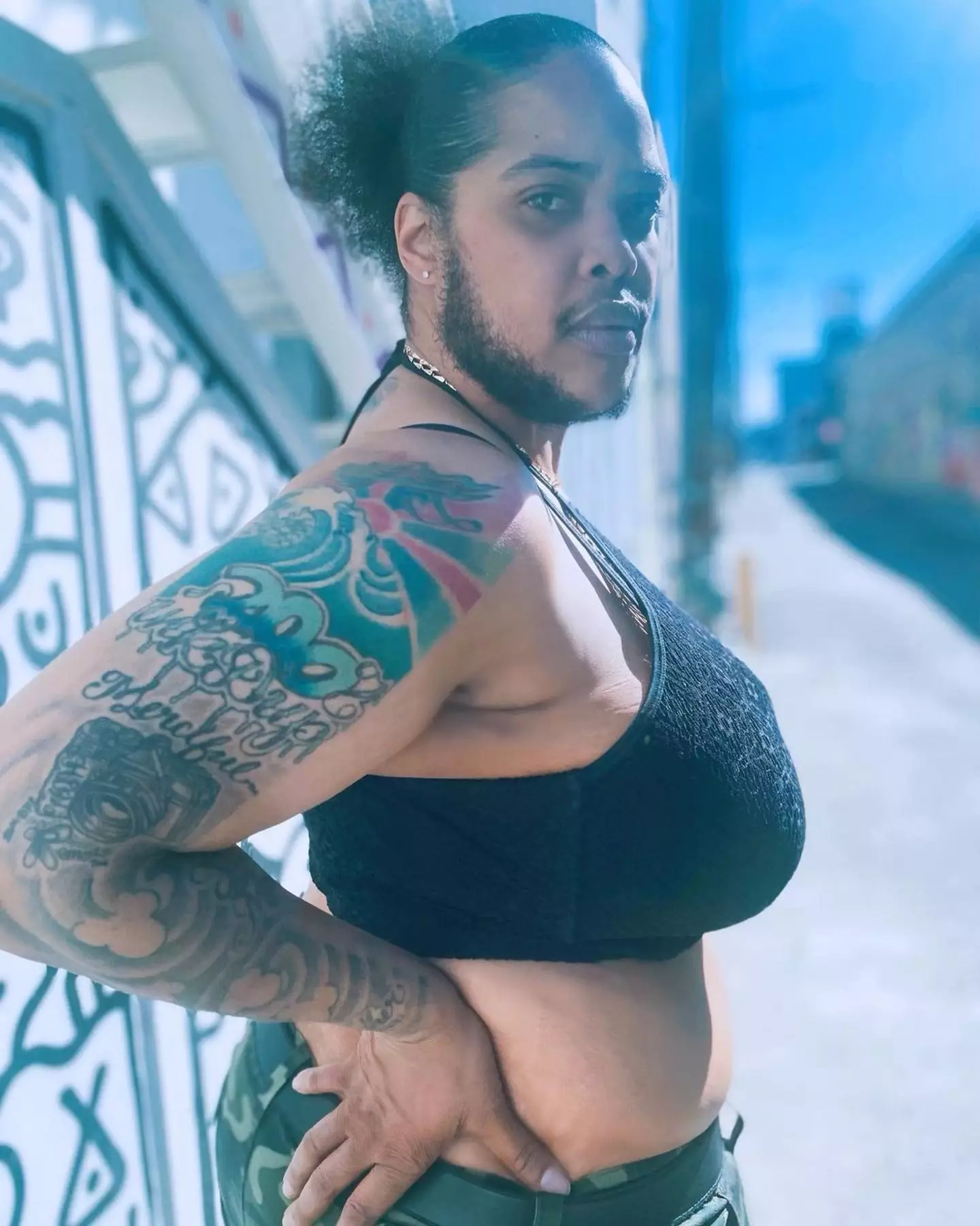 She is now raising awareness about PCOS and Hirsutism.