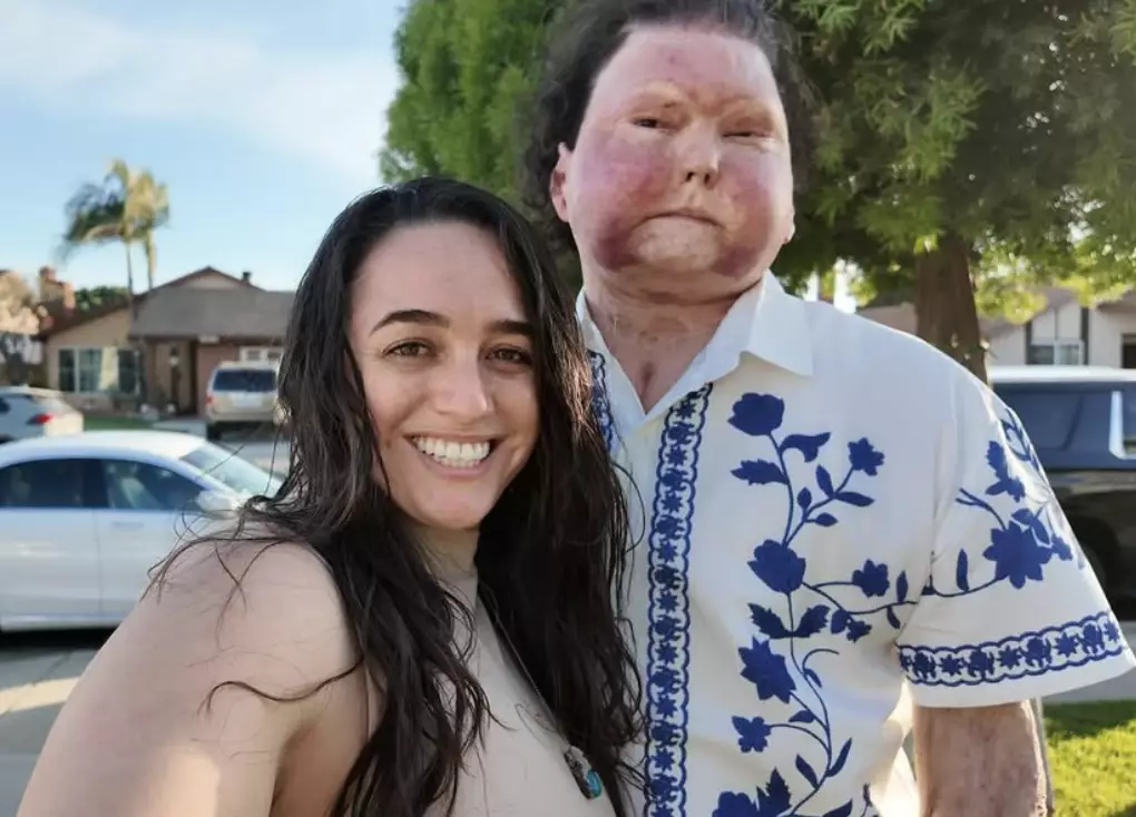 Joe DeMio was the world’s first successful recipient of a face and bilateral hand transplant following a car accident in 2018 (Instagram/@joeroydimeo)