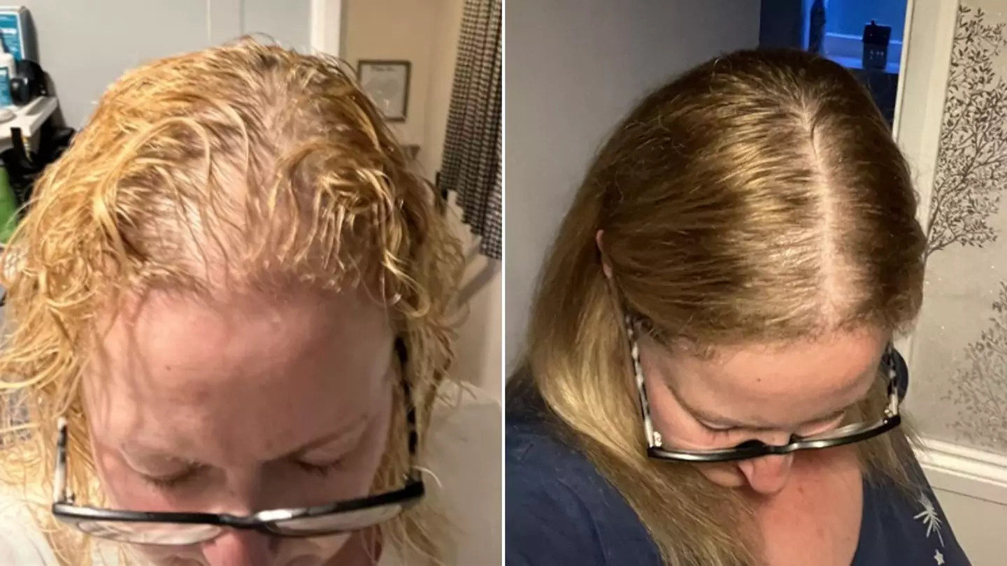 Shocking before-and-after photos show what common supplement is capable of