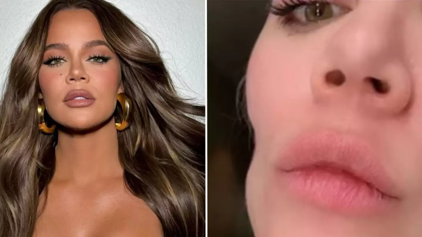 Khloe Kardashian reveals effect of tumour removal with before-and-after pictures