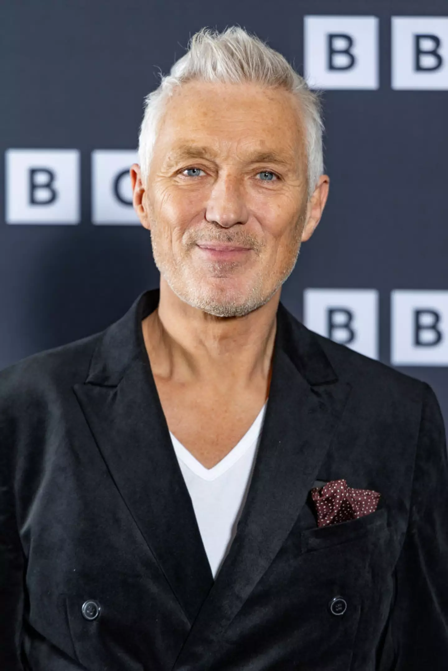 Martin Kemp has been open about his brain tumour ordeal throughout the years. (Shane Anthony Sinclair/Getty Images)