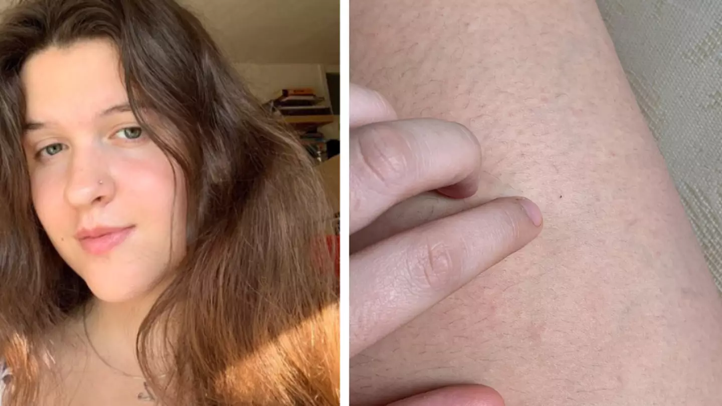Woman Issues Warning After Getting 'Spiked By Needle Injection'