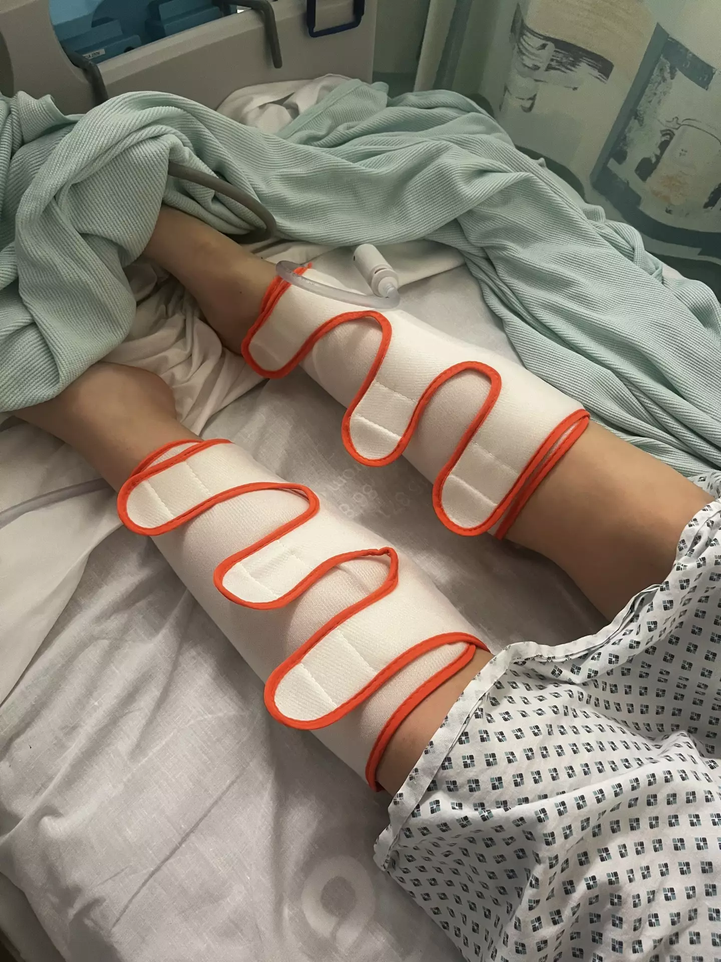 Holly had multiple blood clots in her lungs, stomach and left leg. (Kennedy News and Media)