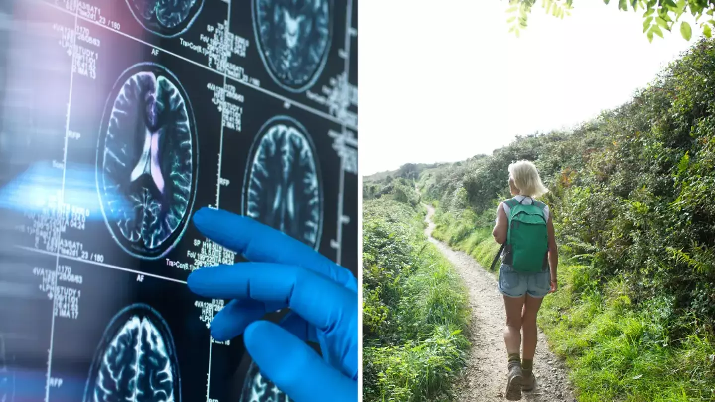 One physical characteristic could actually be a sign you have dementia