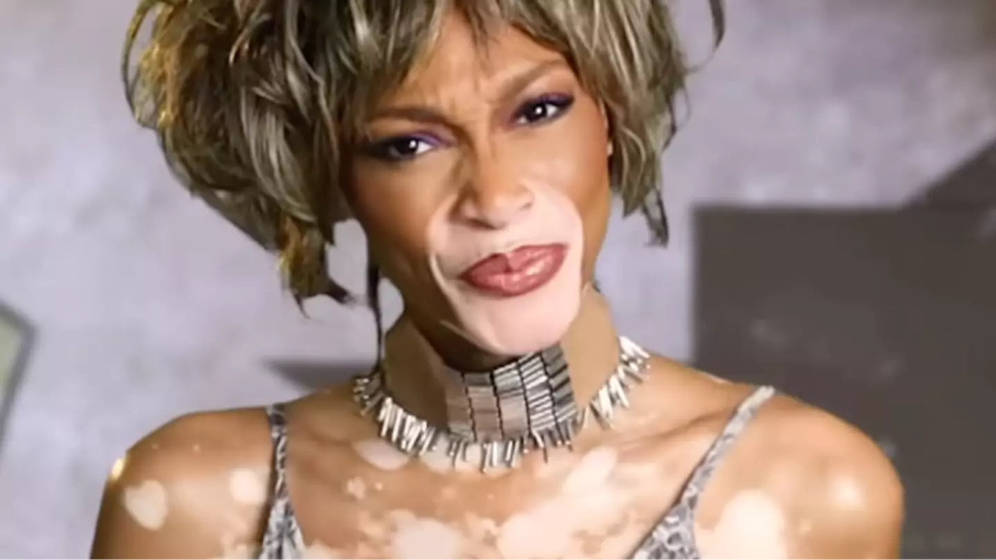 winnieharlow/Instagram