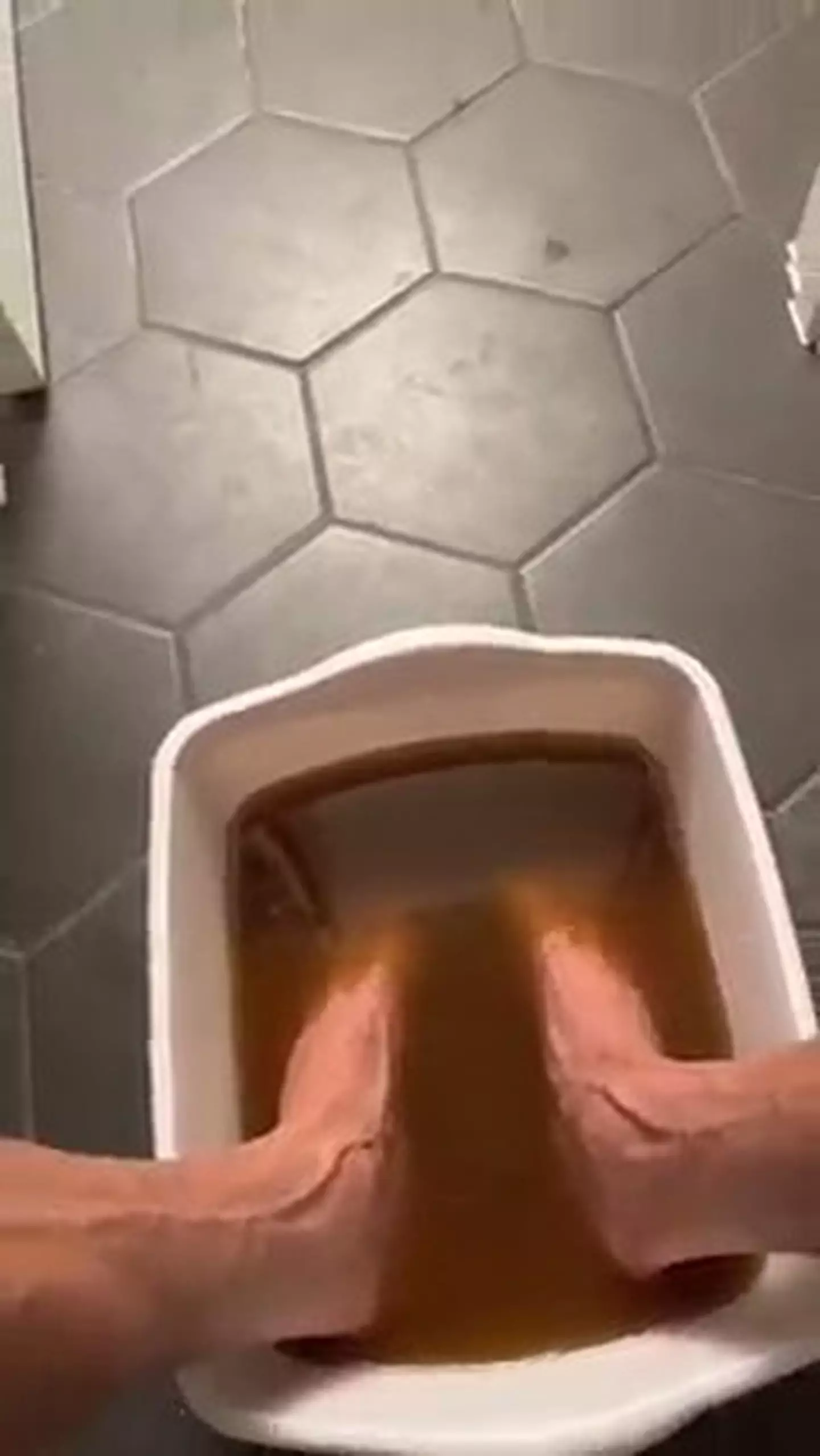 Urine foot soak, anyone?