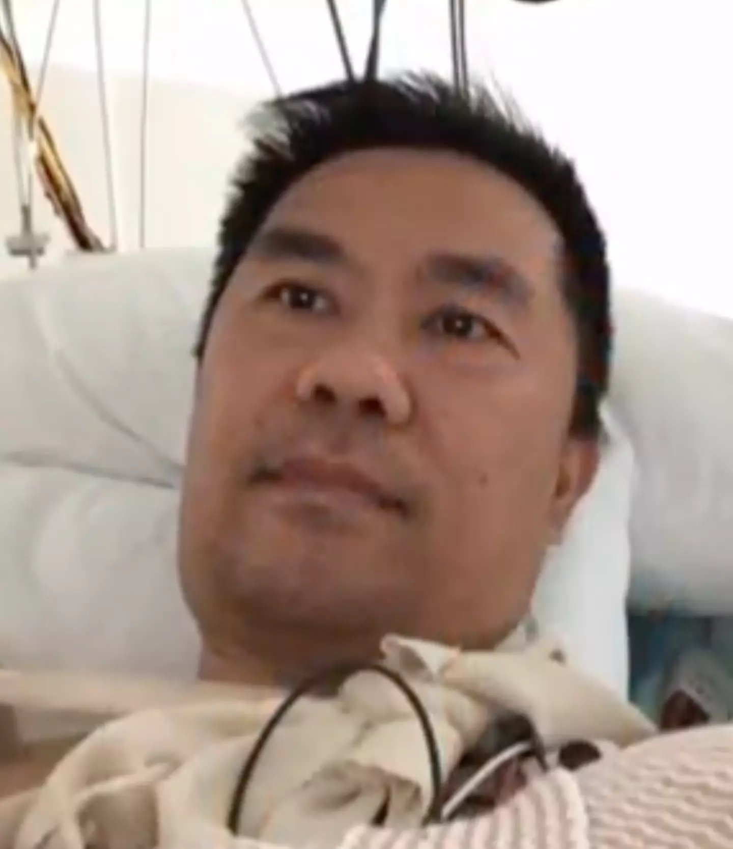 Li had to endure 15 months of therapy after the attack.