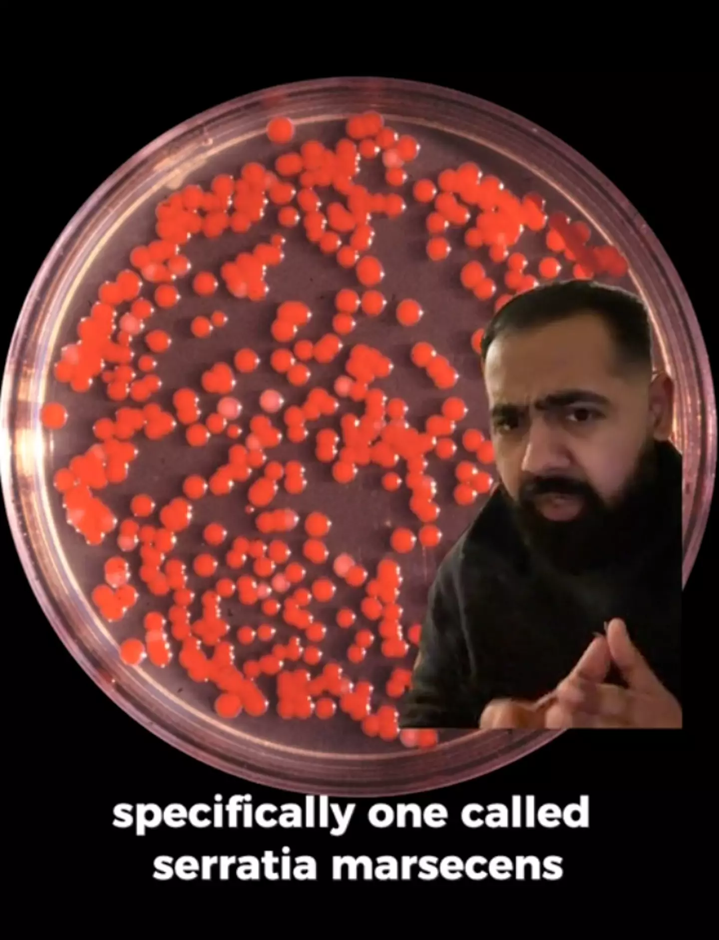 Yes, it's bacteria (TikTok/ @dr.karanr)