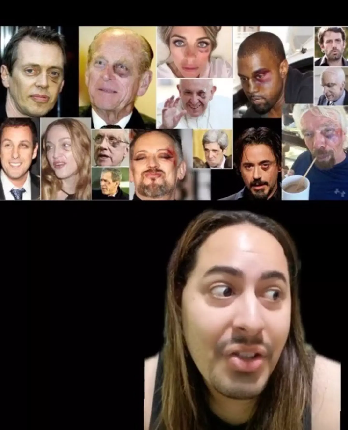 The so-called 'purple eye club'.