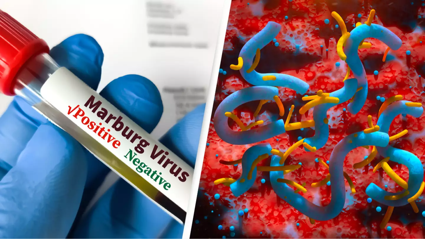 Doctors issue urgent warning over 'eye-bleeding disease' as death toll rises to eight