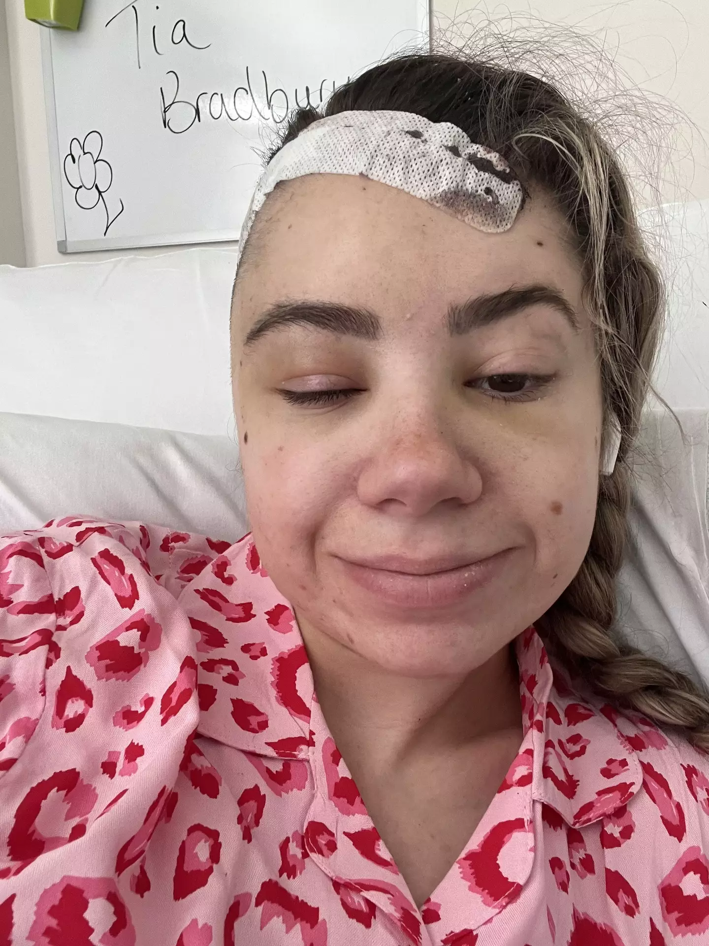 Fortunately, she is now migraine and pain-free (