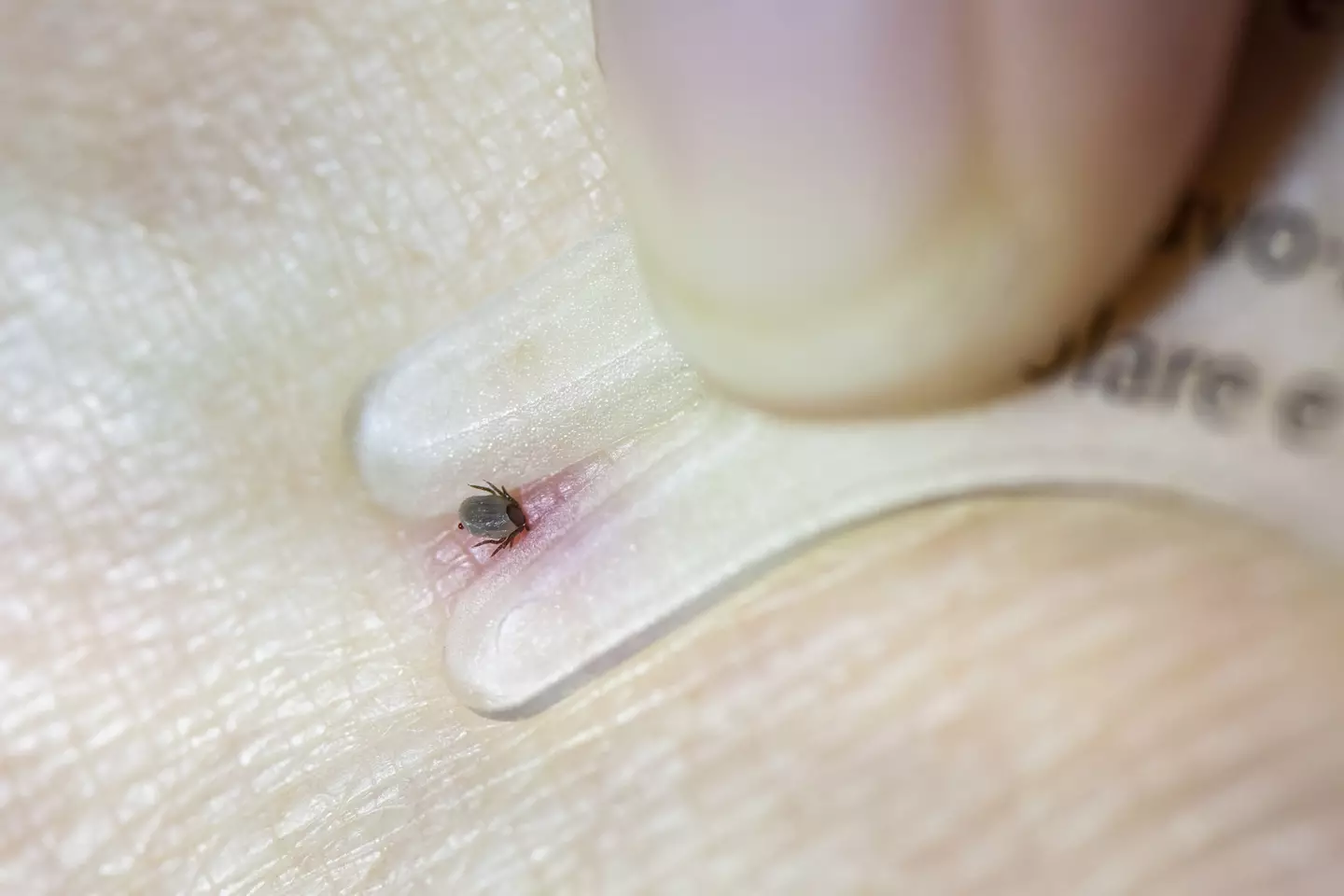 The tiny parasites feed on the blood of mammals and birds (Getty Images)