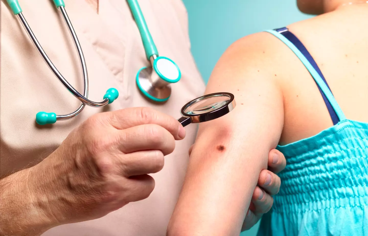 Melanoma is the most common cancer in the US (Getty Images)