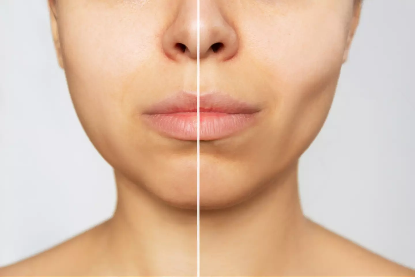 It can cause the face to 'hollow' out (Getty Images)