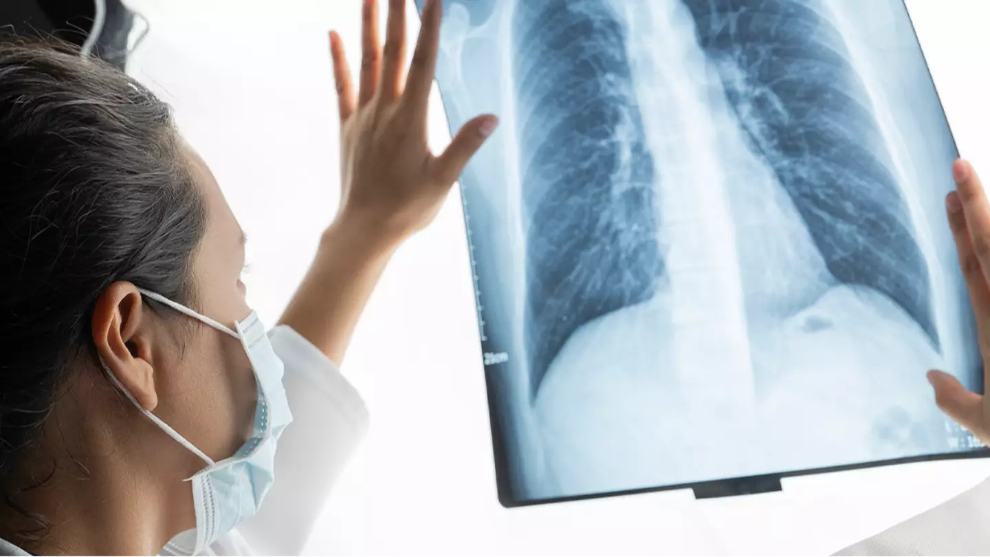 Reason people who have never smoked are possibly being diagnosed with lung cancer