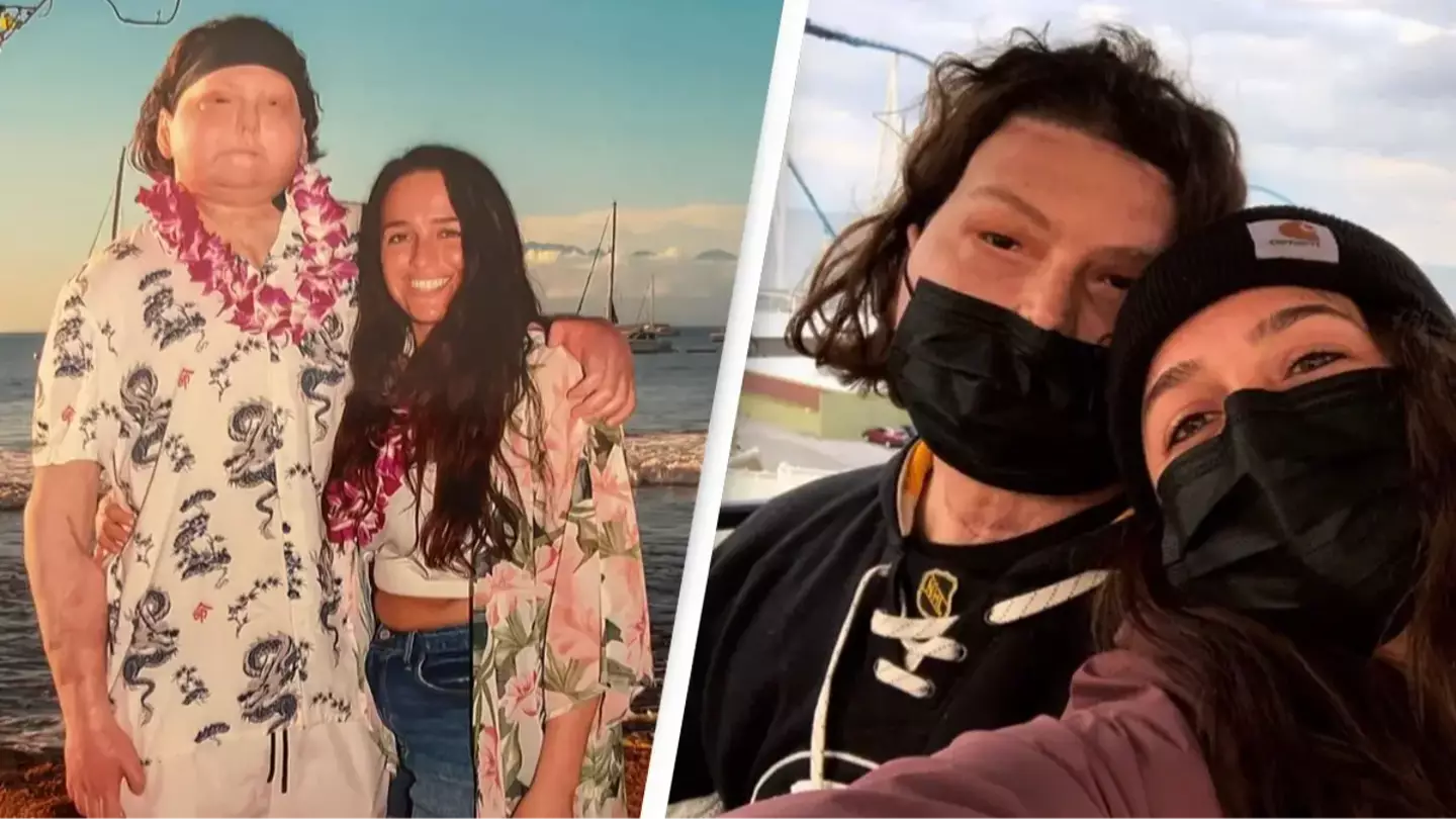 First man to have successful face and double hand transplant shares photos announcing engagement