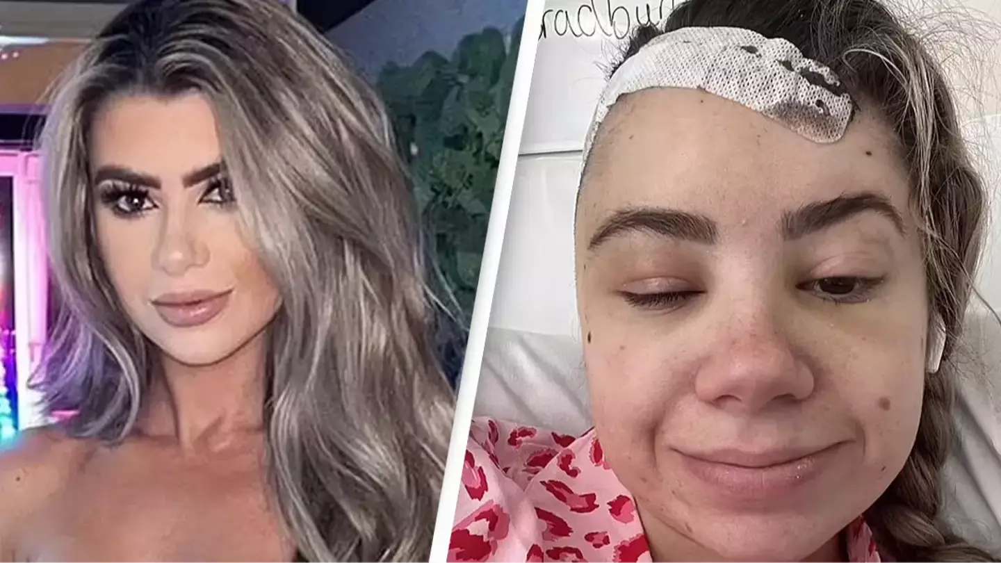 Woman dismissed by doctors for 'migraines' shares shocking diagnosis after begging for MRI scan