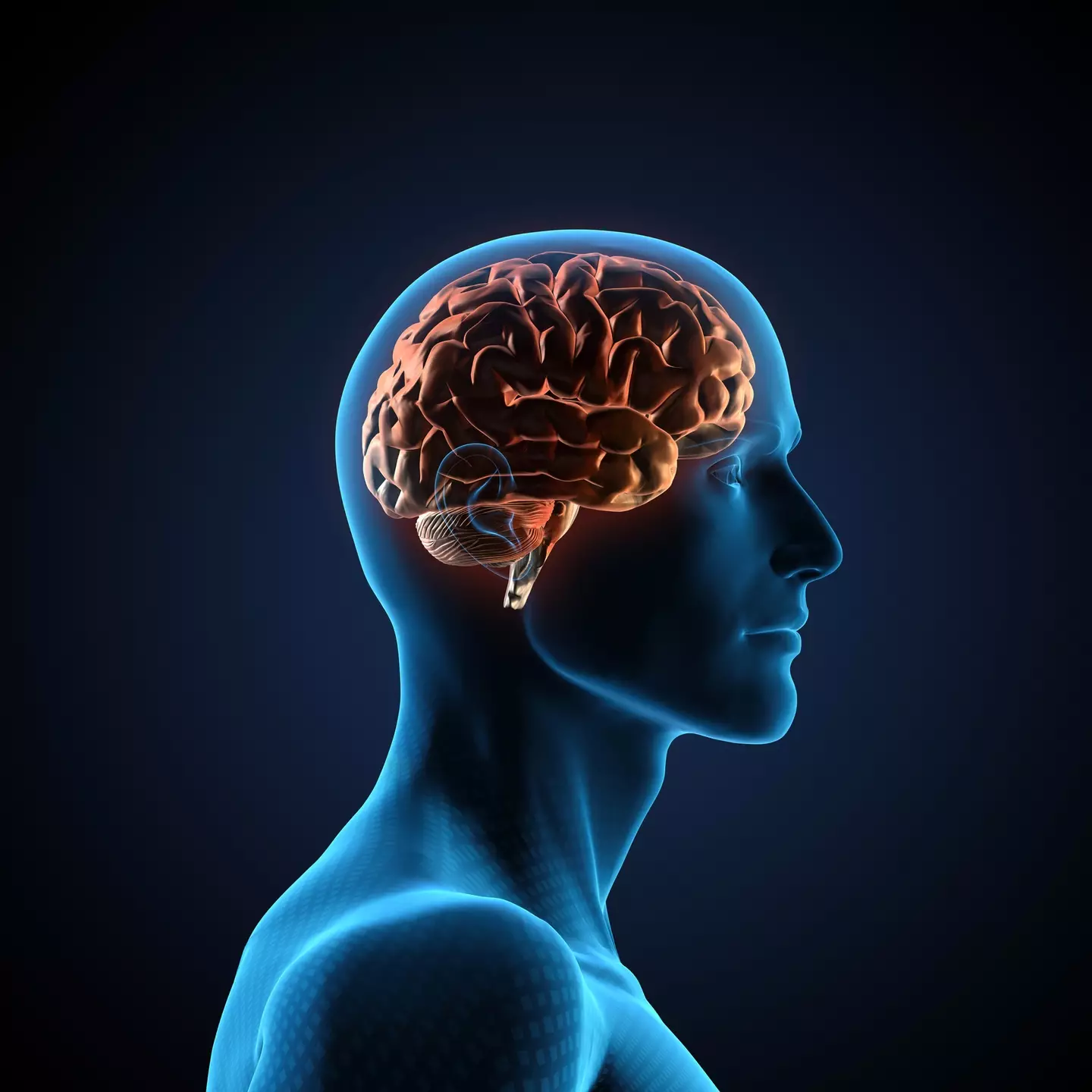 Those living with low IQ levels have revealed what life has been like for them (Getty Images/comotion_design)