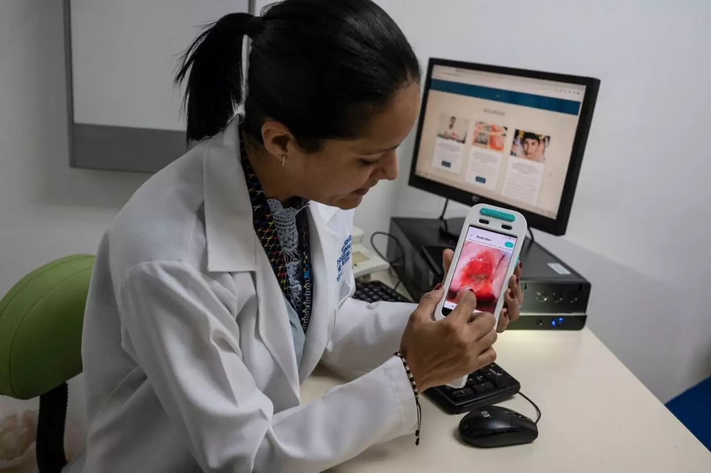 A doctor explains the use of a new intelligent cervical cancer device (YURI CORTEZ/AFP via Getty Images)