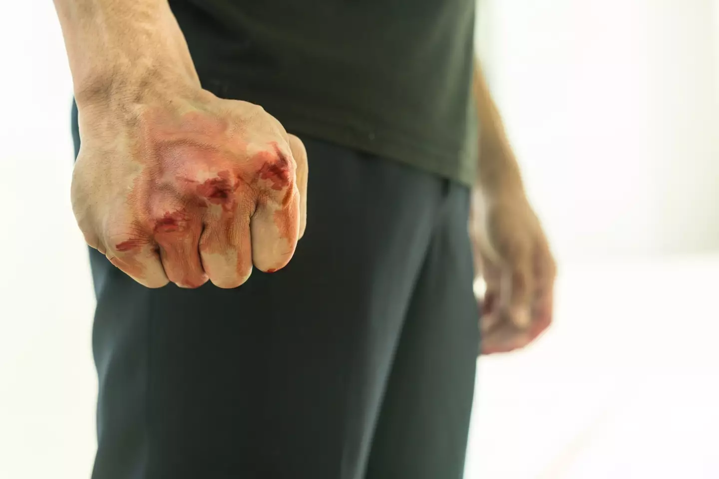 People with ASPD may show a tendency towards violence (Getty Stock Image)