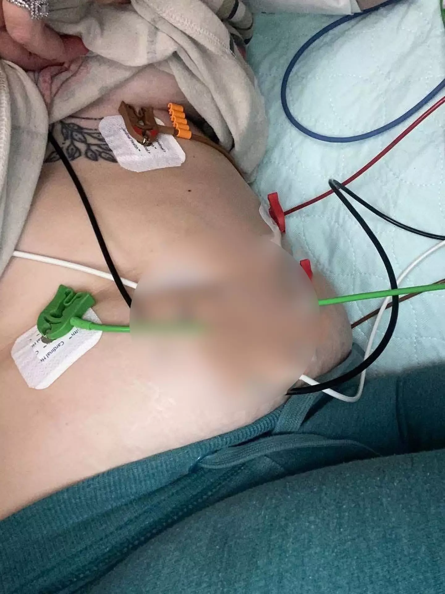 The mom-of-five was diagnosed with 'popcorn lung' due to addictive vaping habits (Kennedy News and Media)