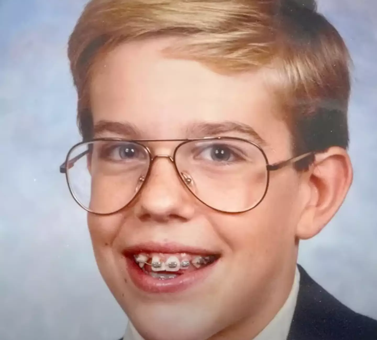 Ed Helms explained he never had a tooth in that spot.