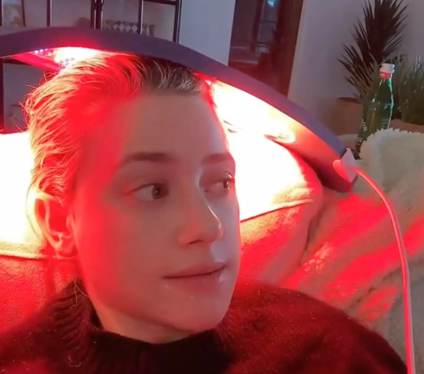 Lili Reinhart has been undergoing treatment for her alopecia.
