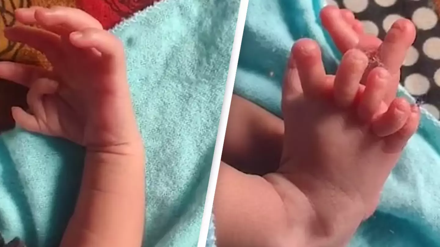 Baby born with 26 fingers and toes hailed as ‘second coming of Hindu goddess’