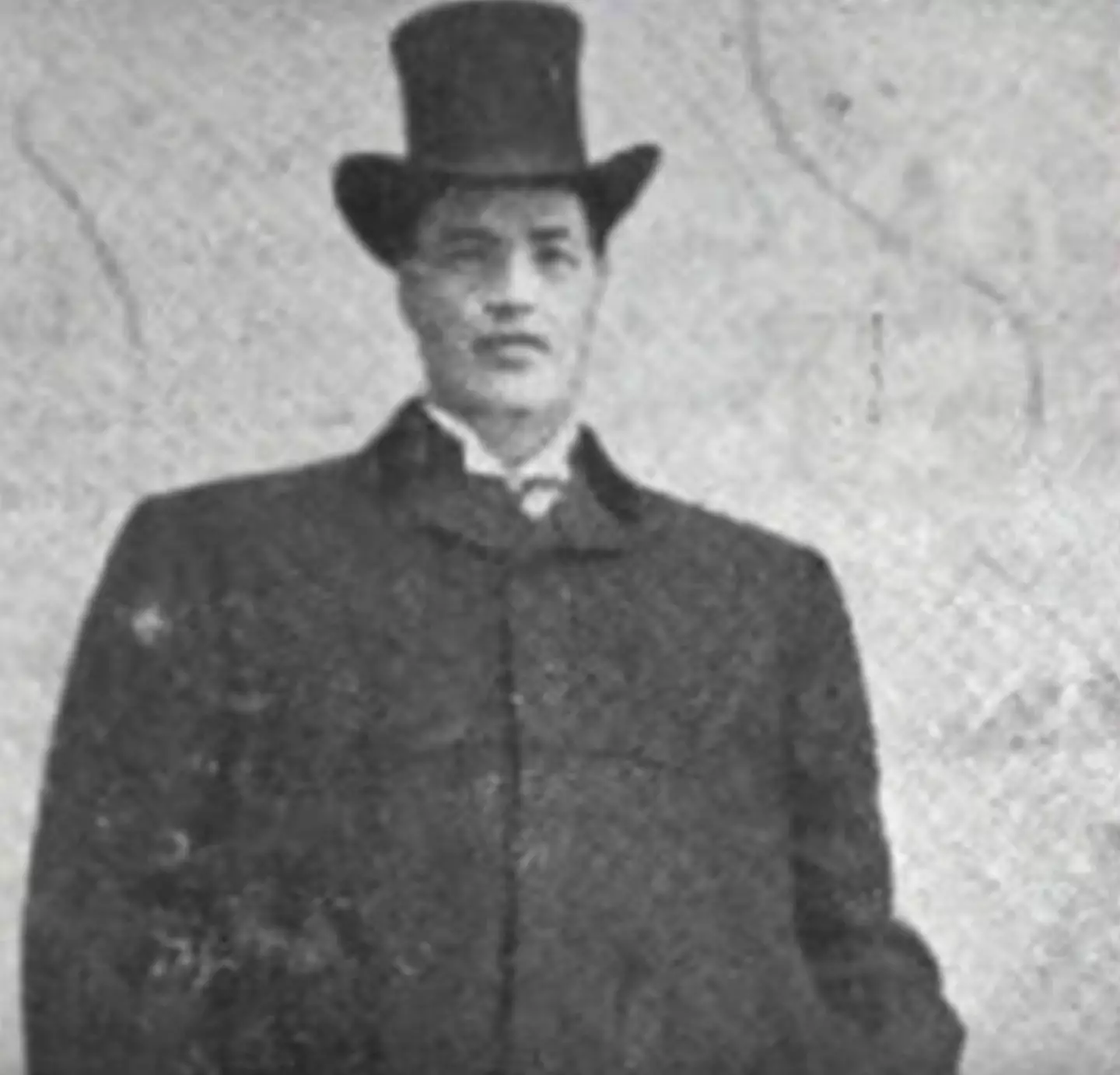 Adam Rainer was initially diagnosed with dwarfism.