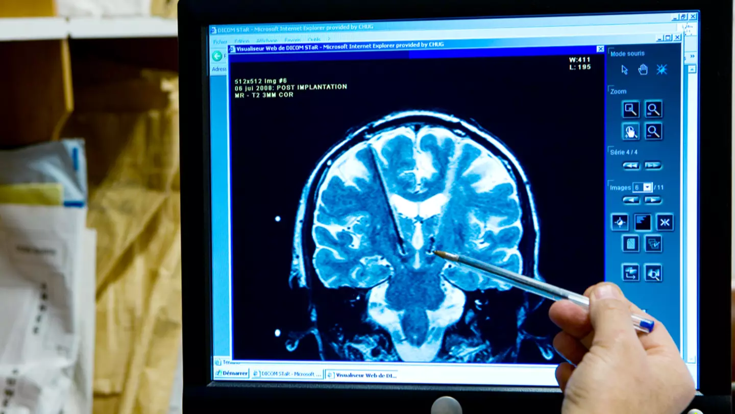 Scientists warn this one daily habit could be quietly shrinking your brain