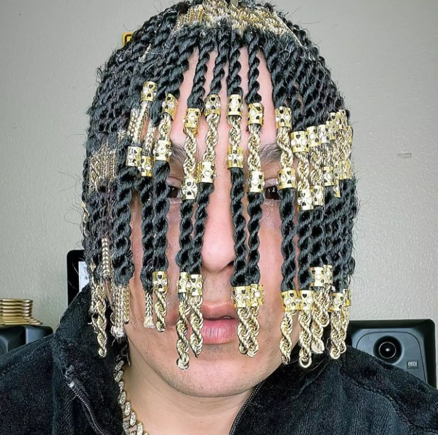 His 'hair' could be putting his health at risk (Instagram/@dansurig)